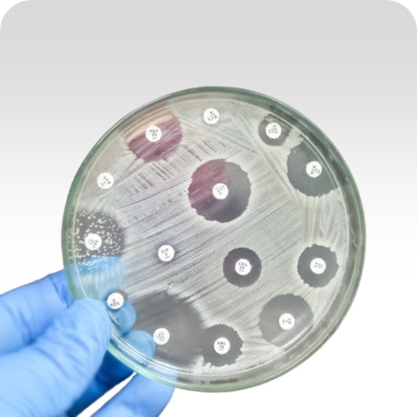 Antibiotic Discs